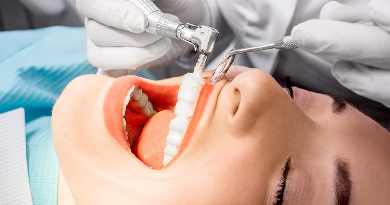Лечение кариеса любой сложности, профессиональная гигиена полости рта с Air Flow, консультация челюстно-лицевого хирурга, хирурга-имплантолога в стоматологии «Сити Дент».