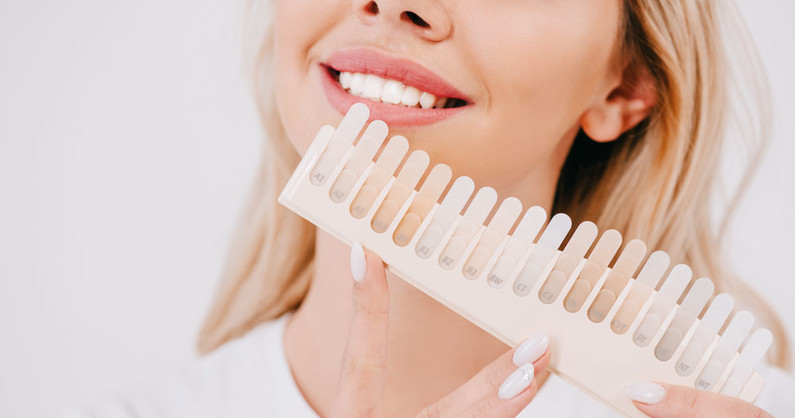 Косметическое отбеливание зубов, установка скайса-стразы от компании «White Style».