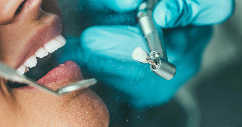 Профессиональная гигиена полости рта с Air Flow, консультация челюстно-лицевого хирурга, хирурга-имплантолога в стоматологии «Сити Дент».