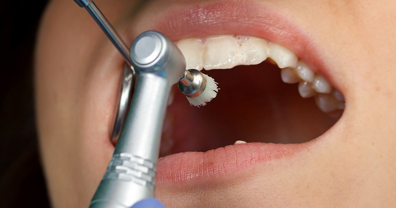 Профессиональная гигиена полости рта с Air Flow, комплексный осмотр стоматолога и составление плана лечения в стоматологии «Дентадайв».